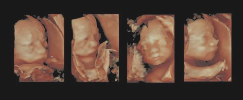 Badania prenatalne: kiedy je wykonać i co można dzięki nim sprawdzić?