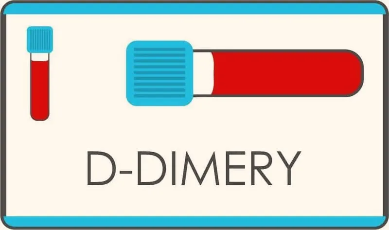 Podwyższone D-dimery – nie zawsze zakrzepica. Kiedy potrzebna jest dalsza diagnostyka?