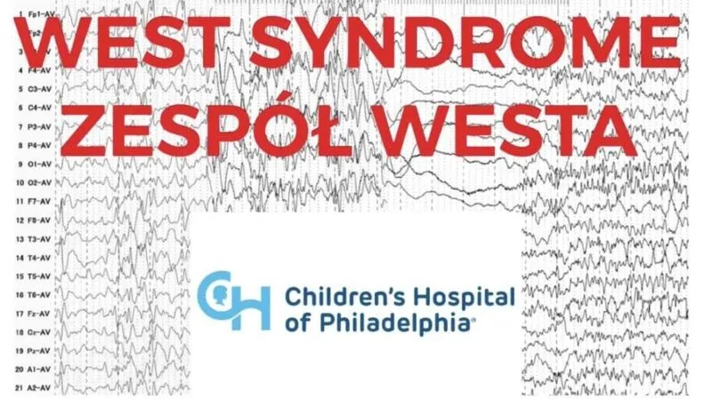 Zespół Westa – objawy, pierwsza pomoc i znaczenie szybkiej diagnozy